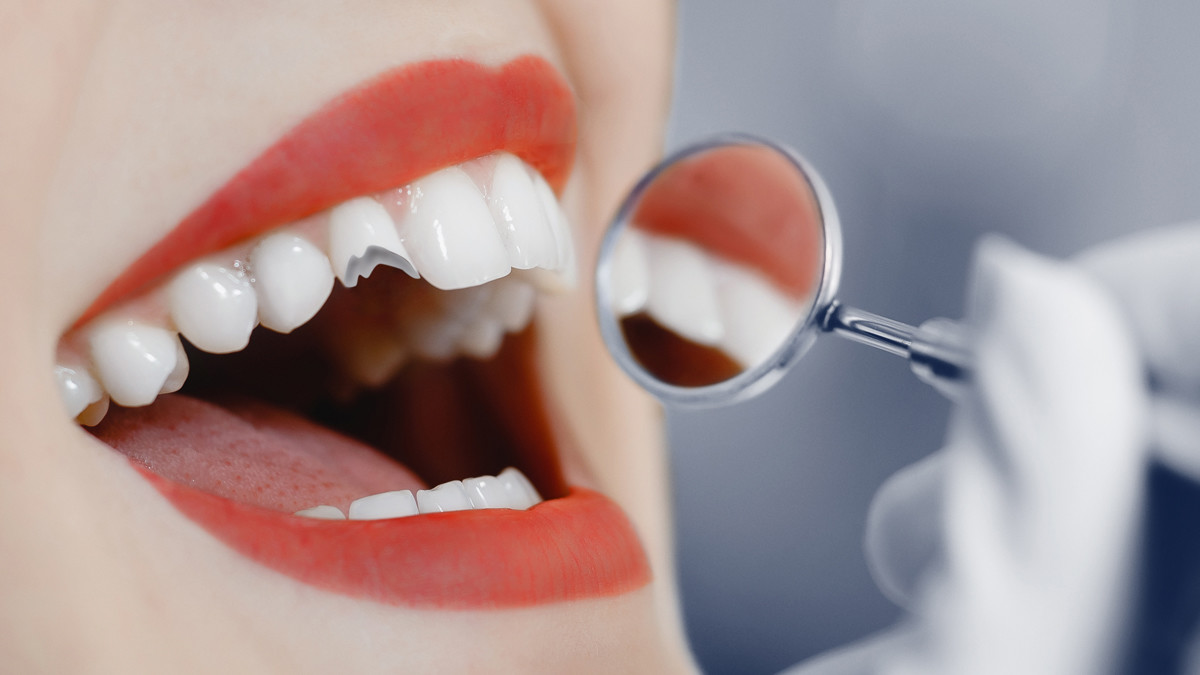 How to choose best dental clinic for you? – Meraki Dental Studio
