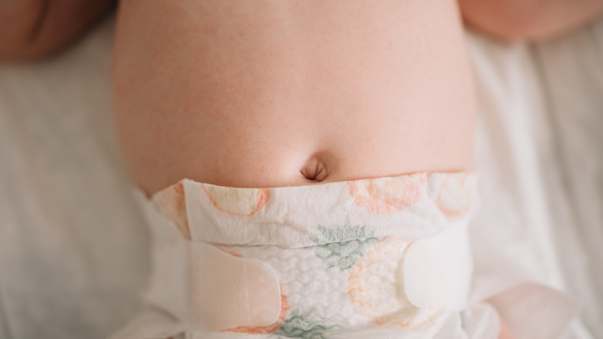 Cegah Pusar Bodong pada Bayi Pakai Koin, Efektifkah? - KlikDokter