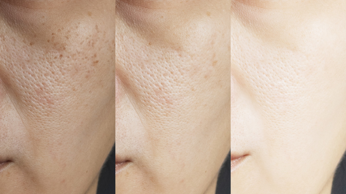 manfaat glutathione kapsul Manfaat Glutathione untuk Kesehatan Kulit dan Tubuh main image 1